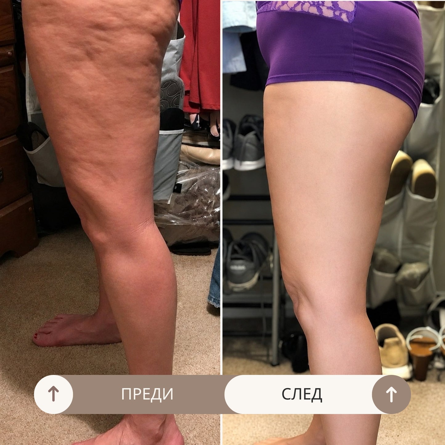 Bio Sculpt Масло Против Целулит