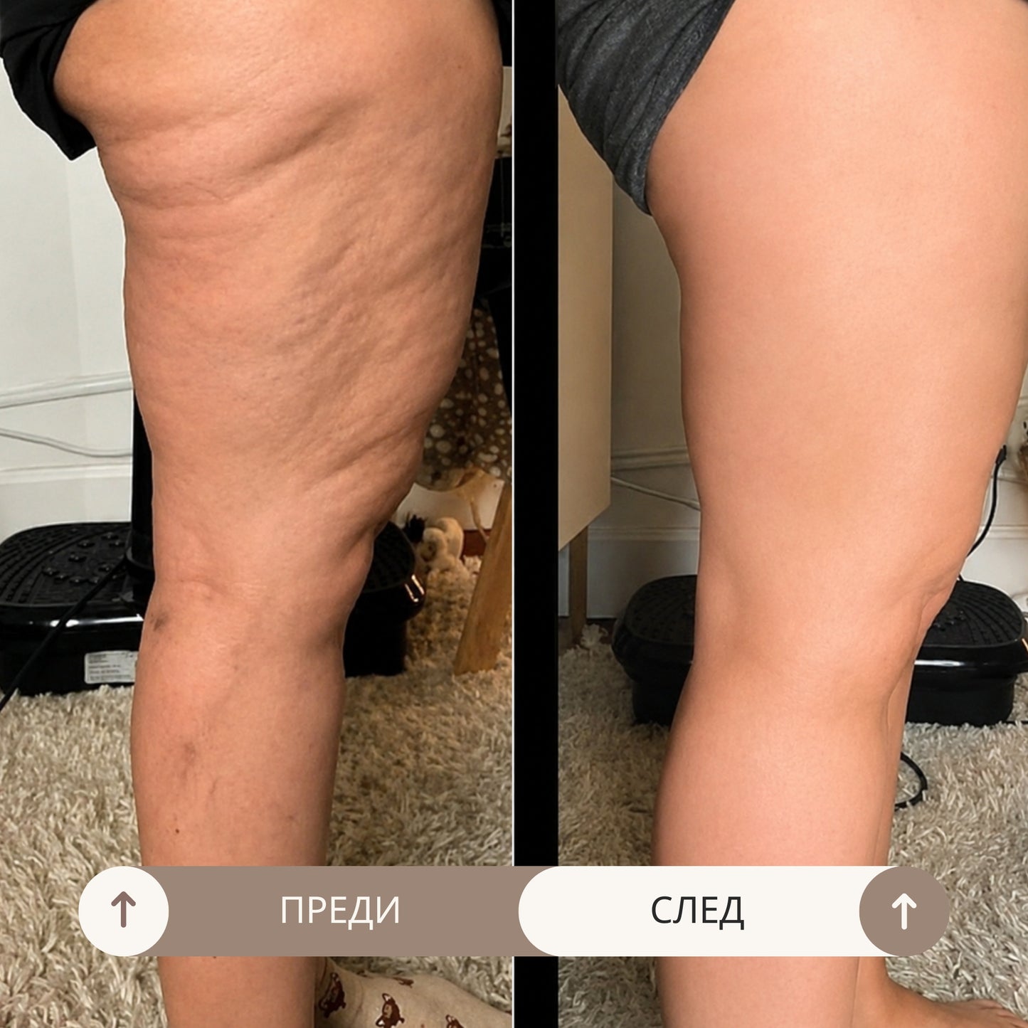 Bio Sculpt Масло Против Целулит
